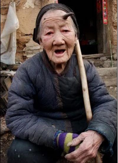 У 101-летней женщины начали расти рога